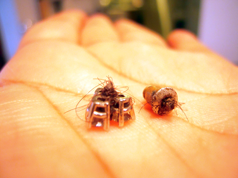 Illustration for article titled The Grossest Earring-Removal Story You'll Hear This Week